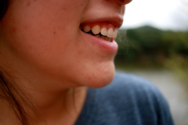 Teenage acne treatments that work 