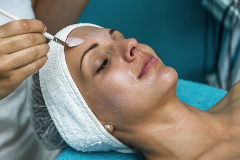 Chemical Peel Northern Virginia