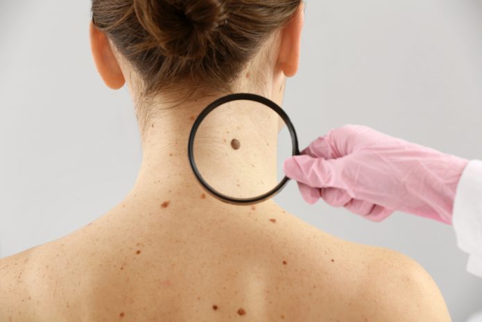 Skin Cancer Excision in Northern Virginia