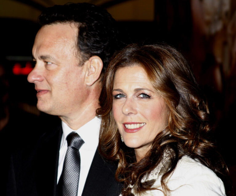 Rita Wilson Opens Up About Botox