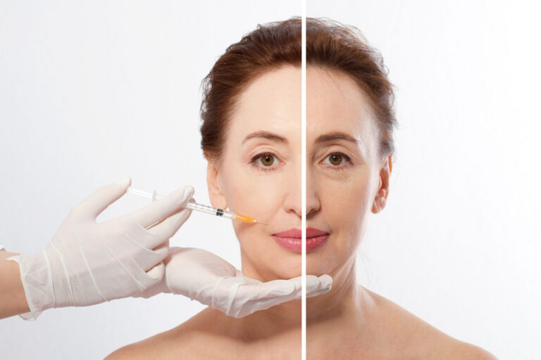 Dermal Fillers Near Me