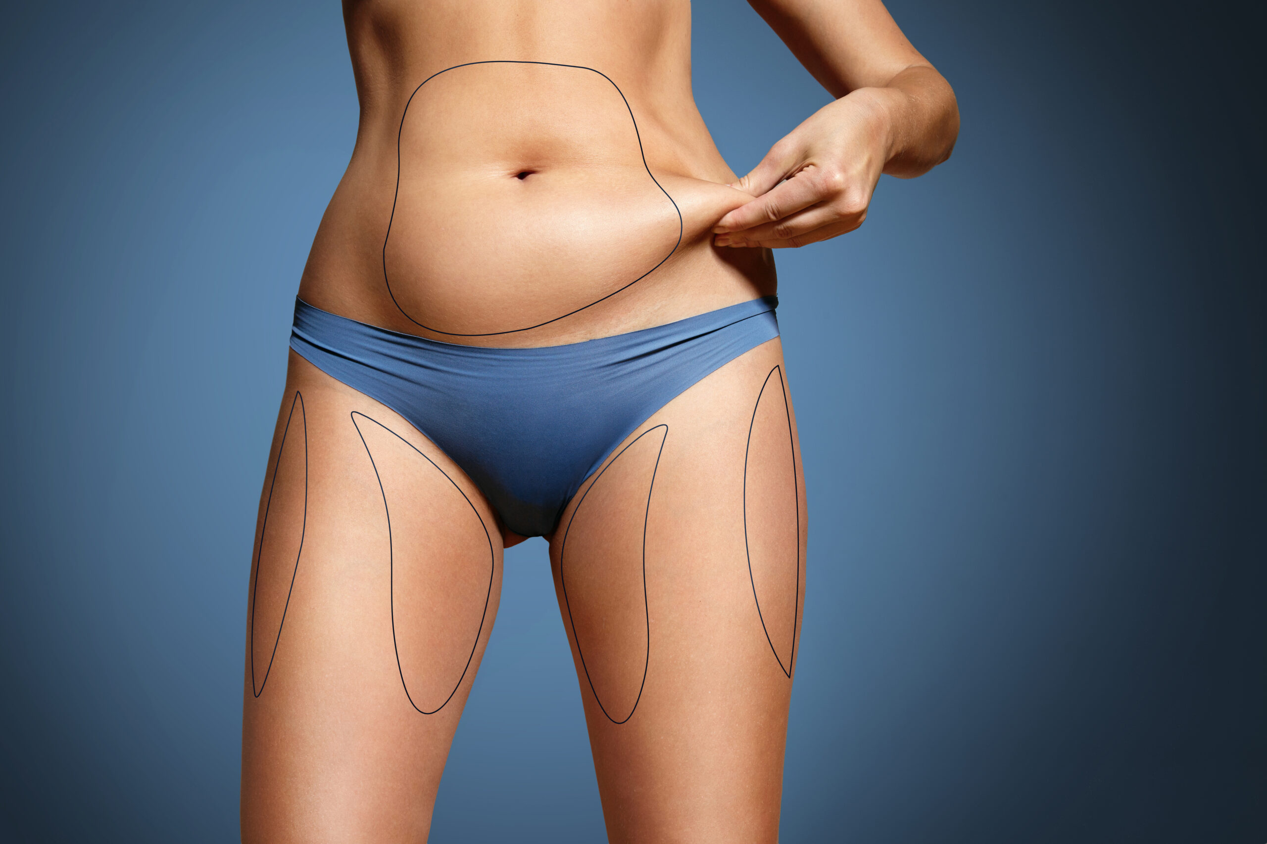 What is the difference between body contouring and liposuction