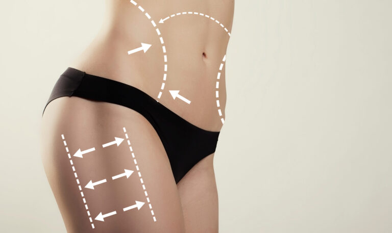 Emsculpt vs CoolSculpting