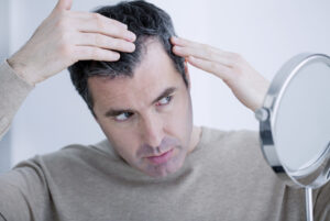 PRF for Hair Loss