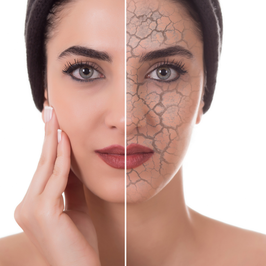 dry winter skin