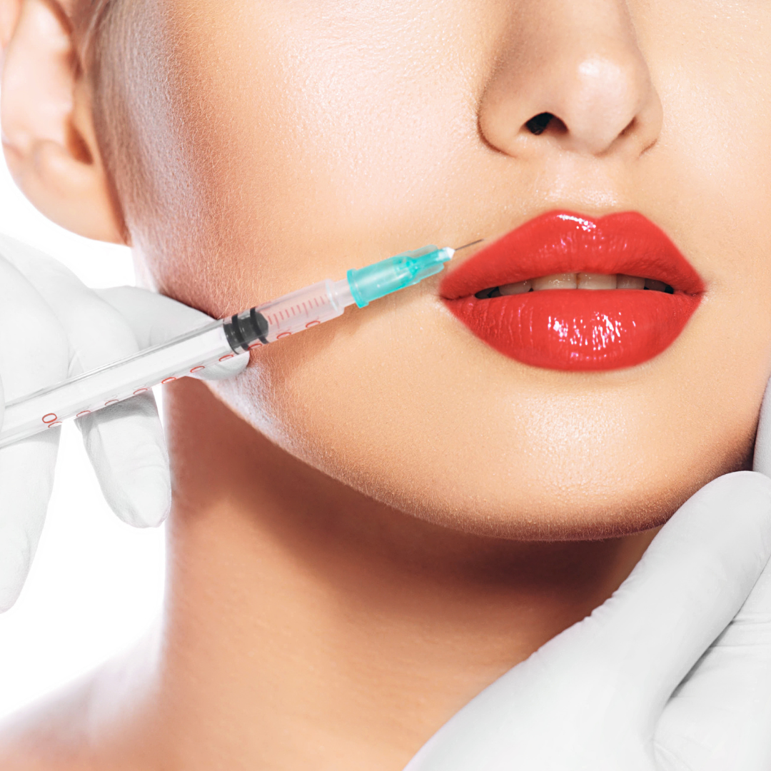 M Shaped Lips Filler Techniques - Reston Dermatology + Cosmetic Center