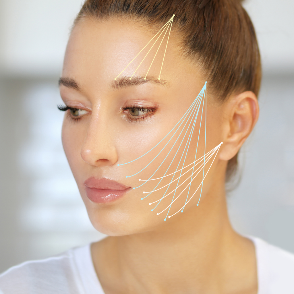 Silhouette Thread Lift vs morpheus8