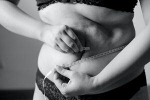 laser liposuction cost