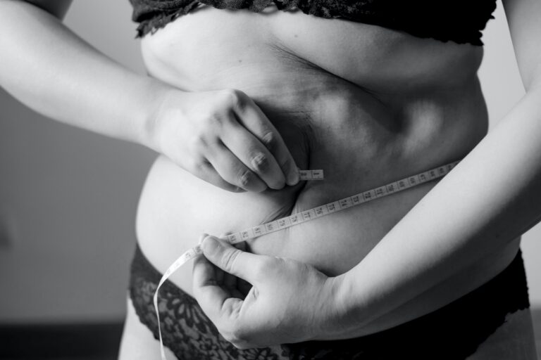 laser liposuction cost