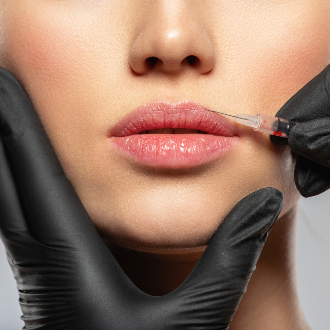 cost of botox lip flip NOrthern Virginia