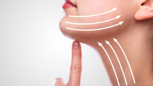 Best Treatment for Sagging Jowls