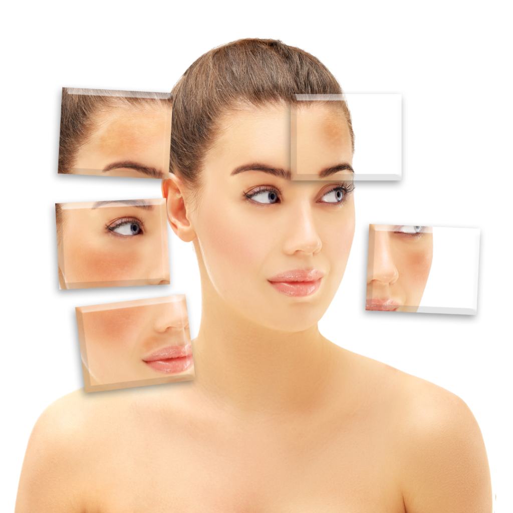 The Advantages of Offering Laser Pigment Removal