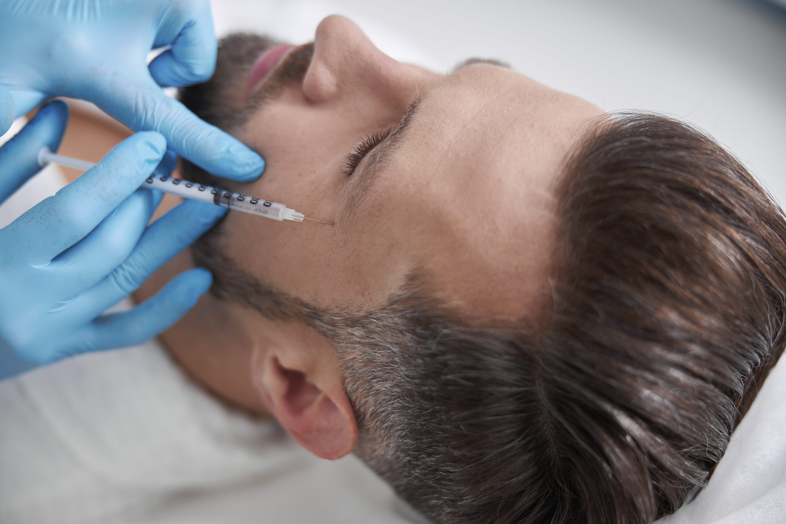 dermal fillers for men Reston Virginia