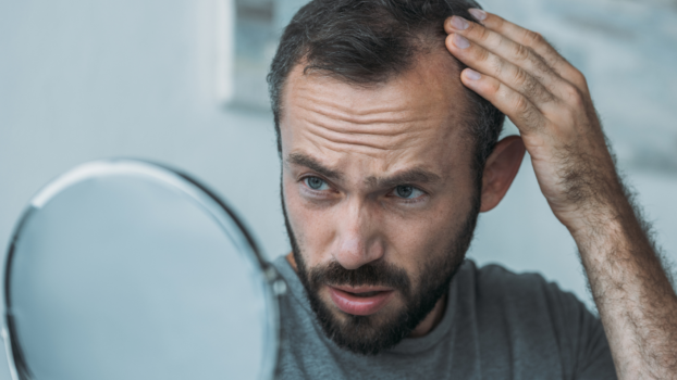 Best Natural Hair Loss Treatment for Men