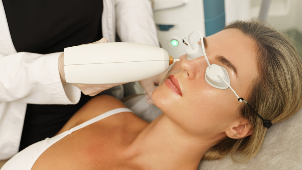 IPL Cost for Dark Spot Reduction Northern Virginia