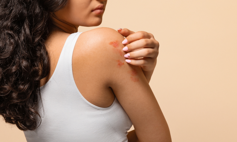 Urgent Care Dermatology Near Ashburn