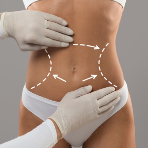 Body Contouring vs. Weight Loss Injections Northern Virginia