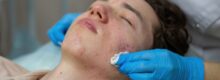 Top Reasons to Treat Acne Early in Reston Virginia