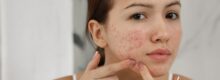 Dangers of Pimple Popping- Tips from a Reston Acne Dermatologist