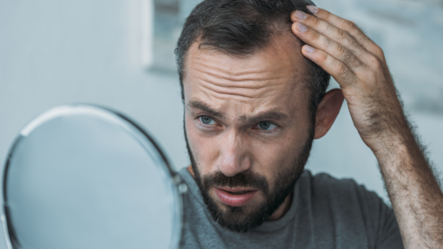 Best Hair Loss Dermatologist Reston