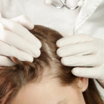 Best Hair Loss Dermatologist Reston