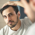 Hair Loss Dermatologist in Reston