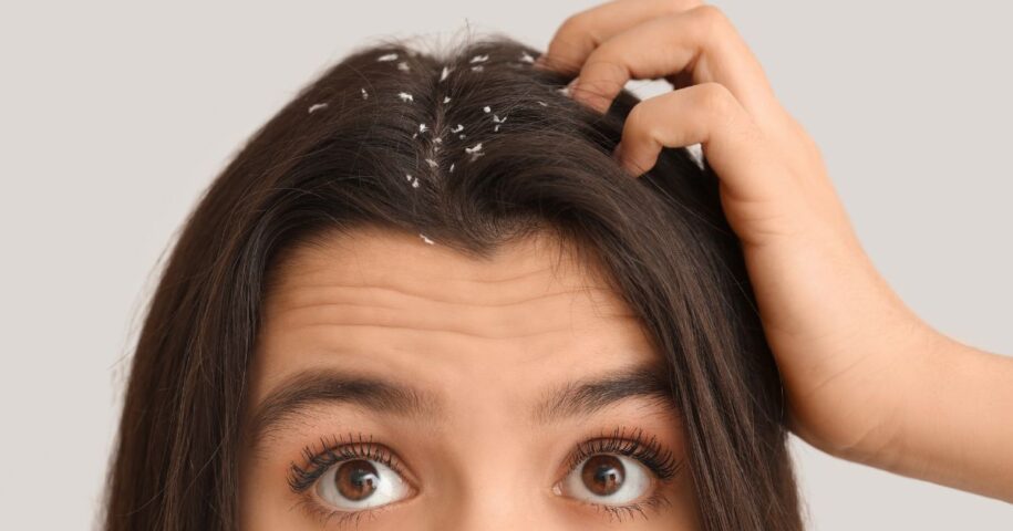 dermatologist for dandruff in Reston