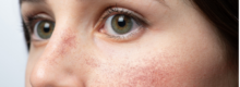 doctor for facial redness Reston