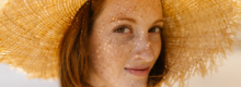 CO2 laser for sun spots