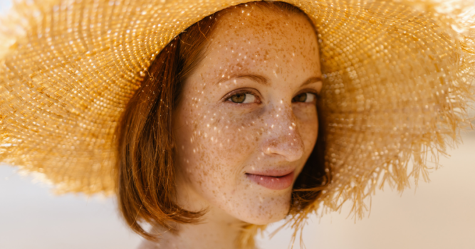 CO2 laser for sun spots