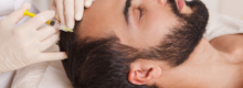 biostimulators for hair loss