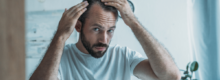 Natural Hair Loss Treatments in Reston