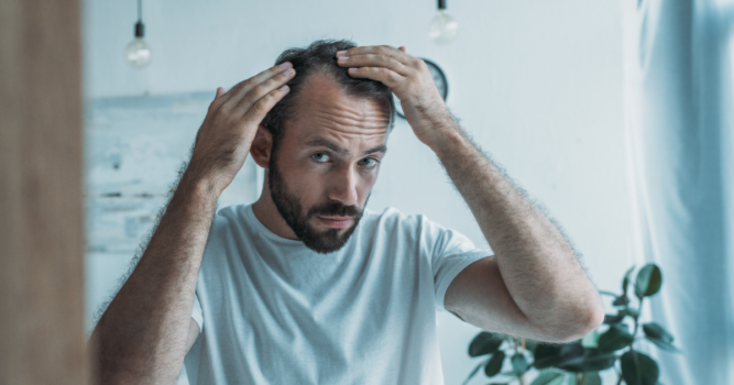 Natural Hair Loss Treatments in Reston