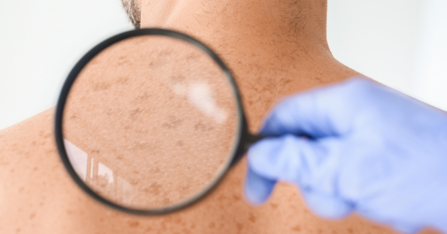 same day dermatology