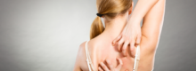 Eczema Specialist in Reston
