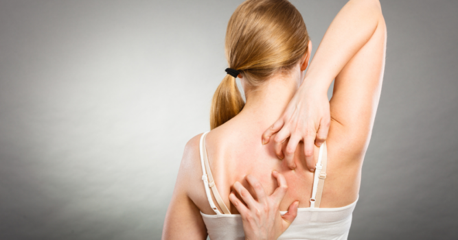 Eczema Specialist in Reston