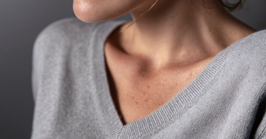 Treatments for Chest Wrinkles virginia