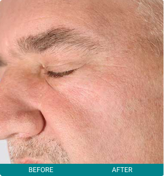 before-after-cancer-checks-1-b