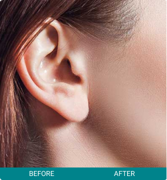 before-after-cancer-checks-2-b