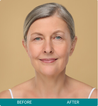 Facial Harmony