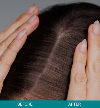 Hair Scalp