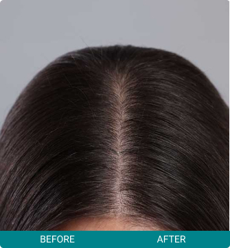 Before and After