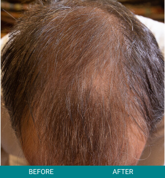 Before and After