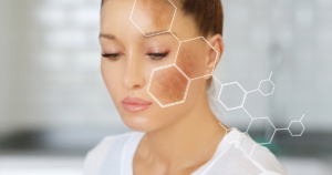 professional dark spot treatments