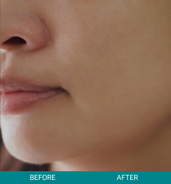 Before & After