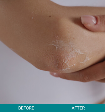 before-after-medical-grade-1-a Before & After