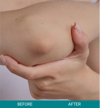 before-after-medical-grade-1-b