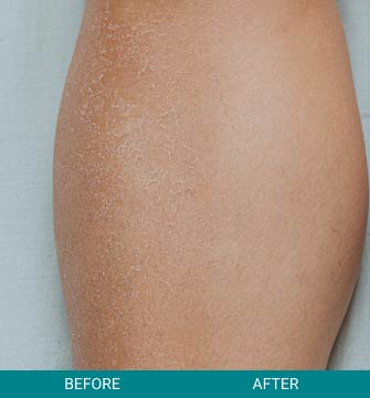 before-after-medical-grade-2-a Before & After