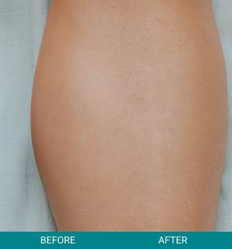 before-after-medical-grade-2-b