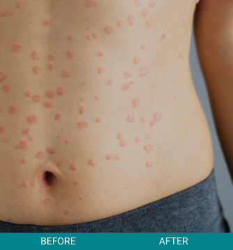 before-after-medical-grade-3-a Before & After